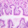 B5, Stomach (Corpus), 20x (H&E)