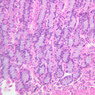 B5, Stomach (Corpus), 20x (H&E)