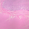 B5, Stomach (Corpus), 2.5x (H&E)