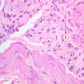 B5, Stomach (Corpus), 40x (H&E)