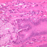 B9, Stomach (Pylorus), 40x (H&E)