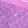 B10, Duodenum, 20x (H&E)