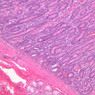 B10, Duodenum, 10x (H&E)