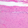B10, Duodenum, 20x (H&E)