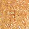 B11, Duodenum, 20x (Ag)