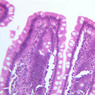 B12, Jejunum, 20x (H&E)