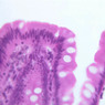 B12, Jejunum, 40x (H&E)