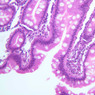 B12, Jejunum, 20x (H&E)