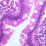 B12, Jejunum, 40x (H&E)