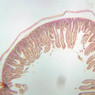 B14, Jejunum, 2.5x (Fe)