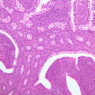 B16, Ileum, 10x (H&E)