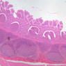 B16, Ileum, 2.5x (H&E)