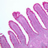 B17, Ileum, 10x (PAS)
