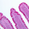 B17, Ileum, 20x (PAS)