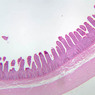 B17, Ileum, 2.5x (PAS)