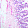 B19, Ileum, 10x (H&E)