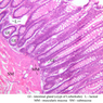 B23, Colon, 10x Labeled (H&E)