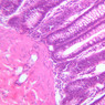 B23, Colon, 20x (H&E)