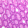 B23, Colon, 20x (H&E)