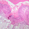 B23, Colon, 2.5x (H&E)