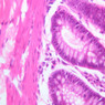 B23, Colon, 40x (H&E)