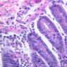 B24, Colon, 40x (H&E)
