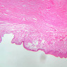 B26, Anal Canal, 2.5x (H&E)