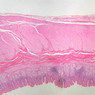 GI