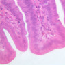 GI