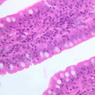 GI
