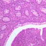 GI