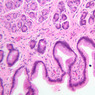 GI