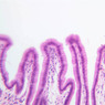 GI
