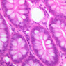GI
