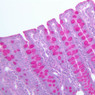 GI