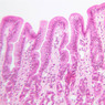 GI