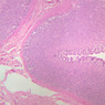 GI