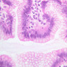 GI
