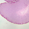 GI