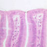 GI