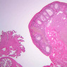 B96, Ovary, 1x (H&E)