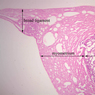 B93, Uterus, 1x Labeled (H&E)
