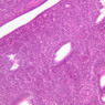 B97, Uterus, 10x (H&E)