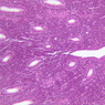 B97, Uterus, 10x (H&E)