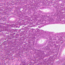 B97, Uterus, 20x (H&E)