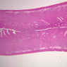 B97, Uterus, 1x (H&E)