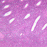B97, Uterus, 10x (H&E)