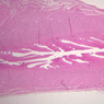 B97, Uterus, 1x (H&E)