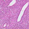 B97, Uterus, 20x (H&E)