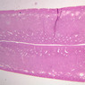 B97, Uterus, 1x (H&E)